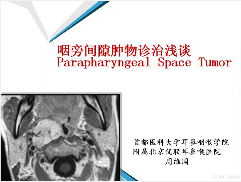 《咽旁间隙肿物诊治浅谈》