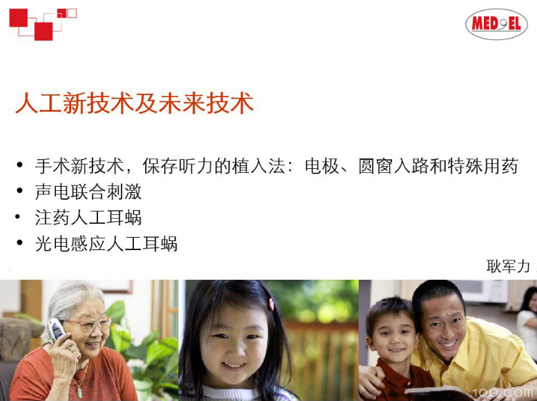 《人工耳蜗新技术》