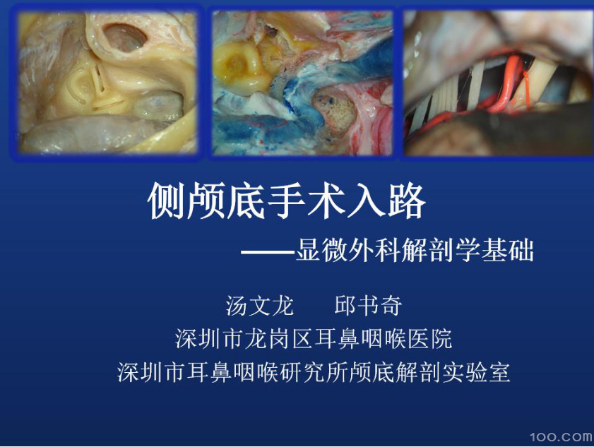 颅底手术的解剖学基础及耳内镜解剖初探