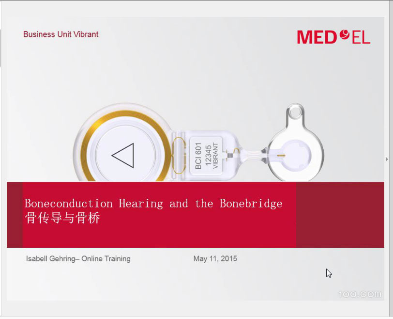 《骨传导助听设备软带骨桥和骨传导植入体骨桥》