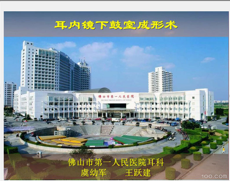 《耳内镜下鼓室成形术》