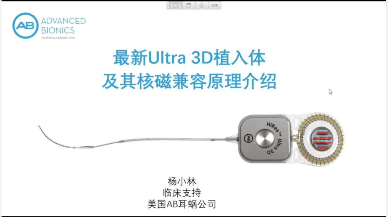 Ultra 3D植入体及其核磁兼容原理介绍